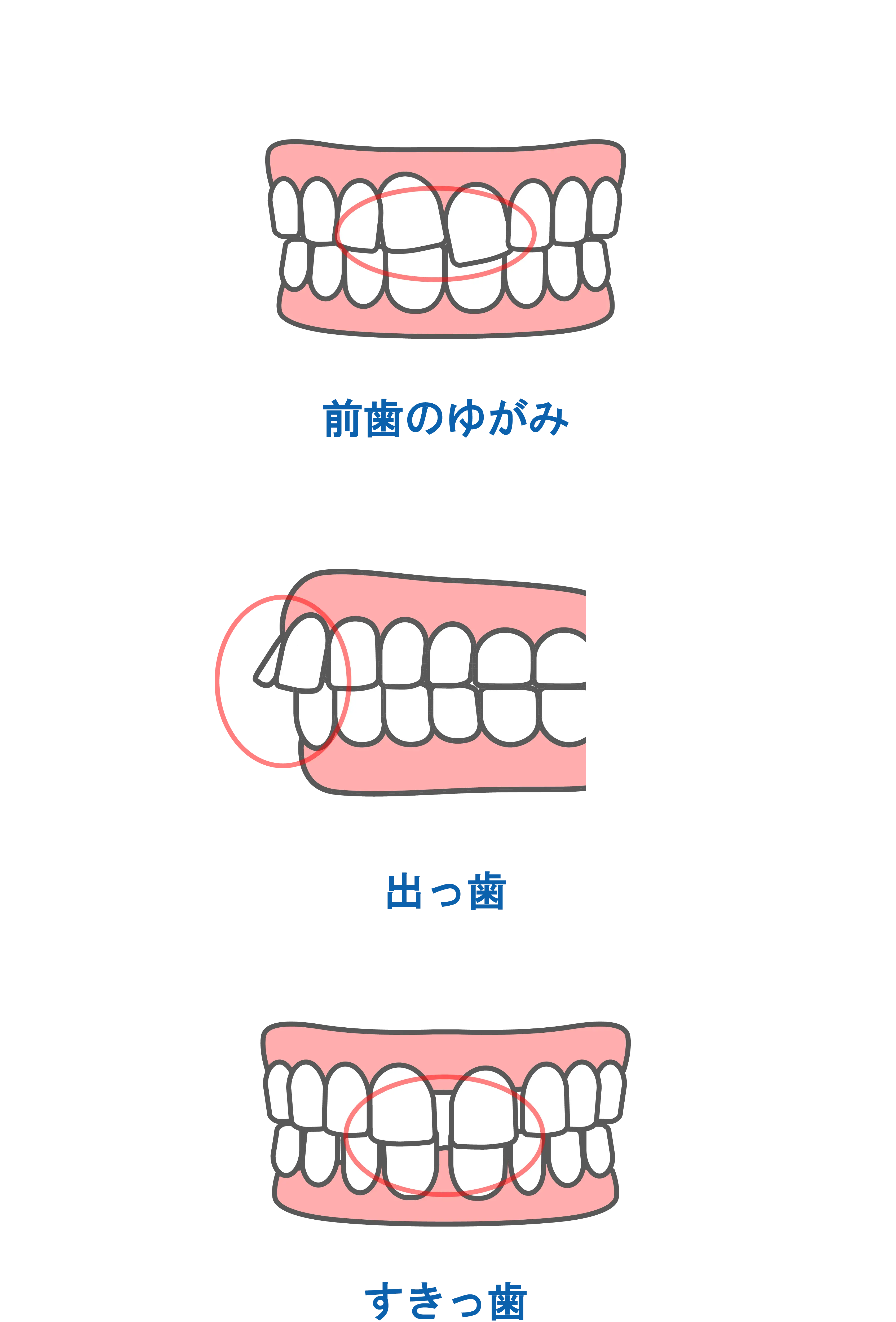 部分矯正の悩み｜東京・港区の歯医者