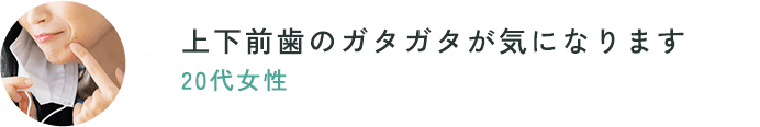 歯の歪みがずっと気になっています。