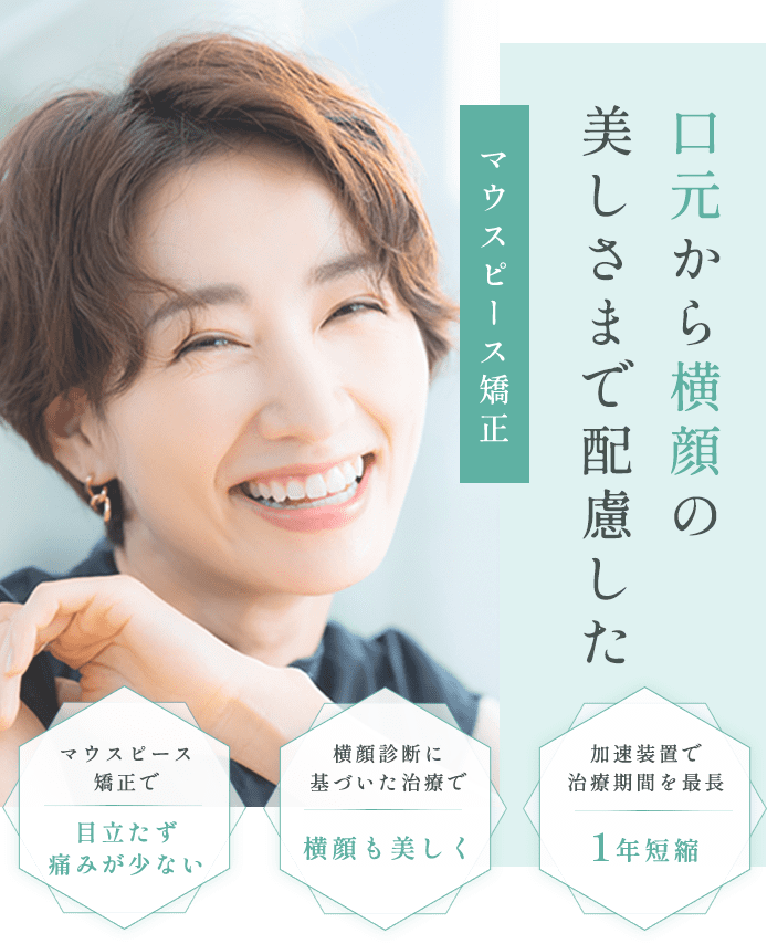 口元から横顔の美しさまで配慮したマウスピース矯正