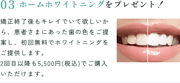 ホームホワイトニングをプレゼント!